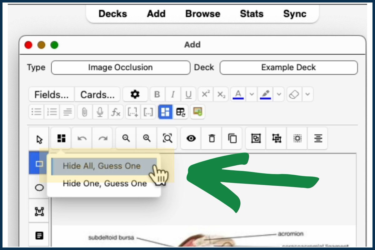 Creating an Anki Image Occlusion Card Step 6: Click "Hide All, Guess One"