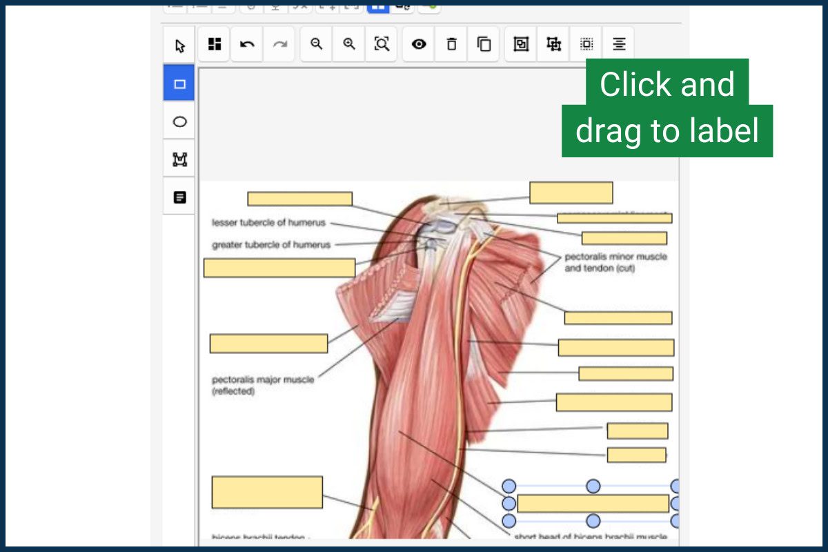 Creating an Anki Image Occlusion Card Step 8: Create your labels
